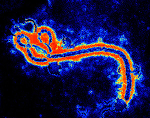 恐怖的埃博拉病毒