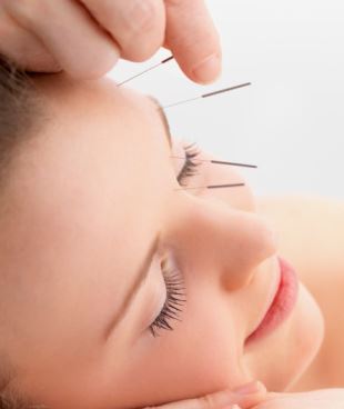 针灸减肥可瘦脸？