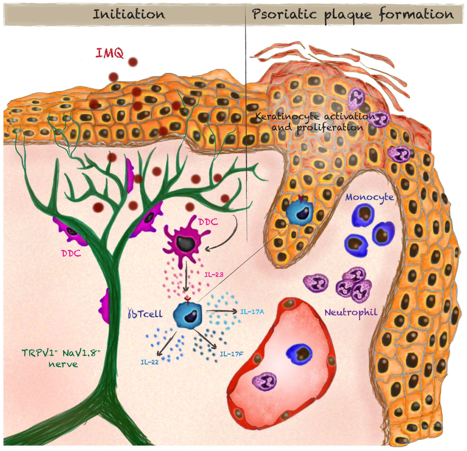 Nature:炎症中所涉及的周围神经元