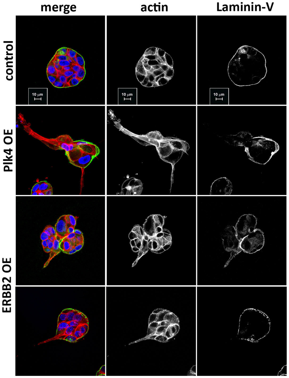 Nature:多余的中心体怎样驱动侵袭性癌症