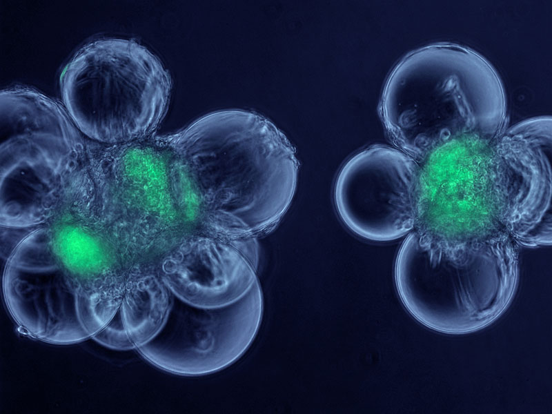 Science：干细胞自我更新所需最少因子被发现
