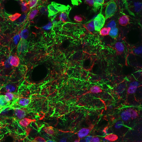 阿尔兹海默症相关神经元路径