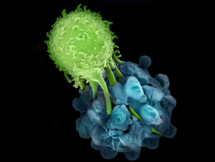 Sci Transl Med:自体免疫疾病的新疗法