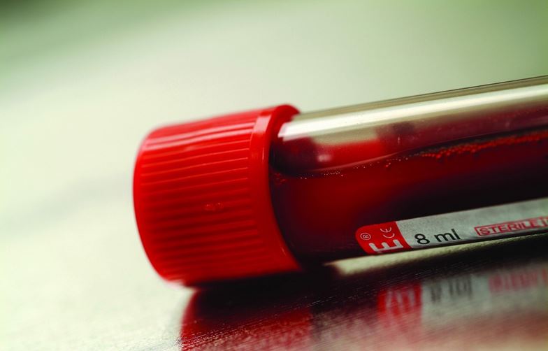 或许可通过血液检测是否有自杀倾向