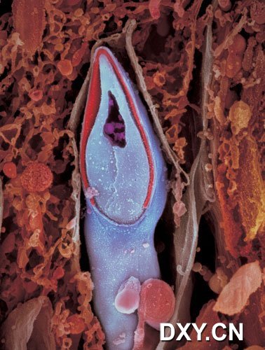 精子的纵断剖面，精子的遗传物质存储在“头部”