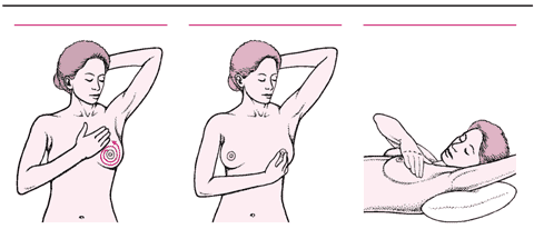 乳房自我检查
