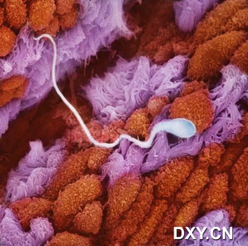 一个精子正在徘徊于输卵管黏膜褶皱区域，寻找结合的卵子