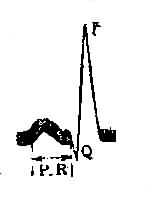 心电图各波及间期的测量方法