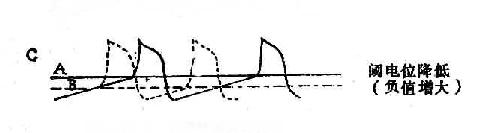 自律性改变的机理